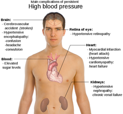 High Blood Pressure Complications